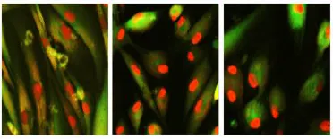 Chemical cocktails can rejuvenate and reverse the age of senescent human skin cells by restoring the compartmentalization of the red fluorescent protein in the nucleus. Image Harvard University