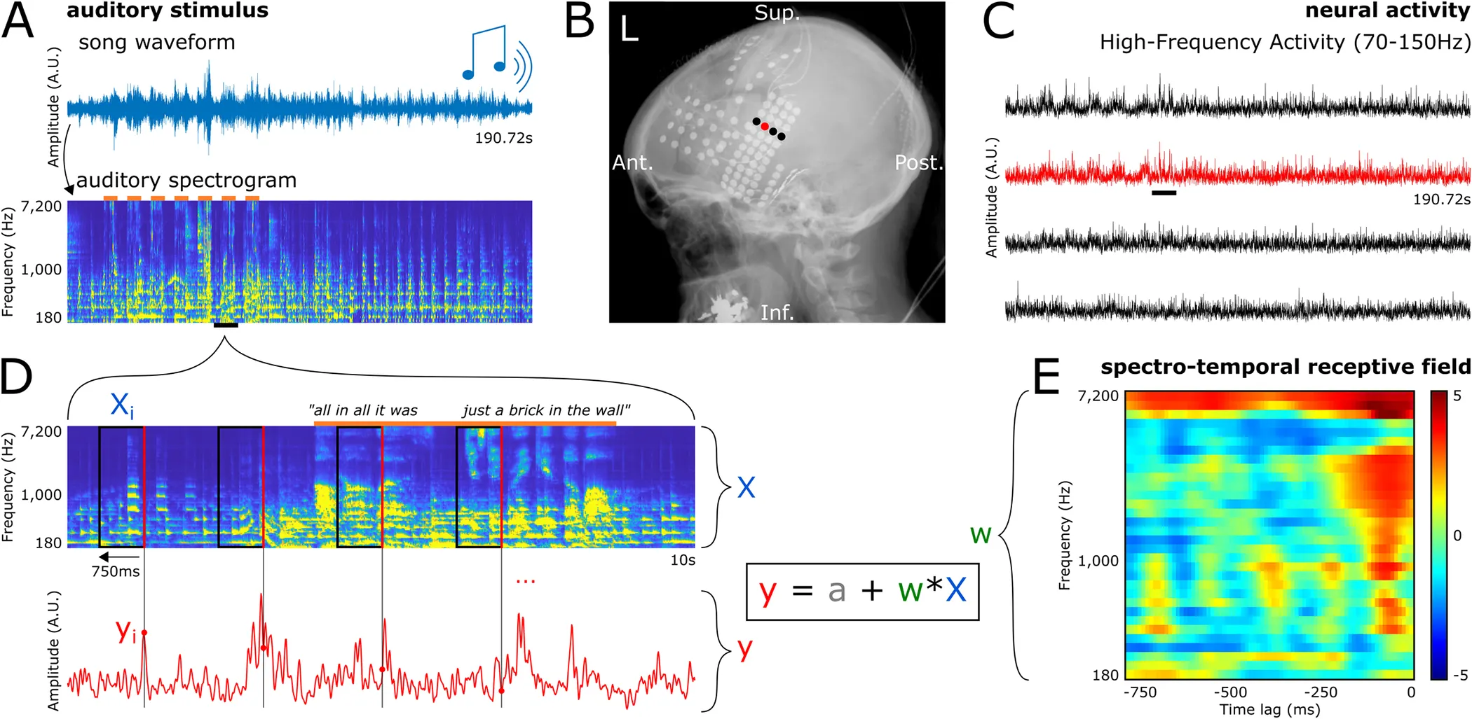 AI Can Now Reproduce Music by Reading Minds - Decrypt