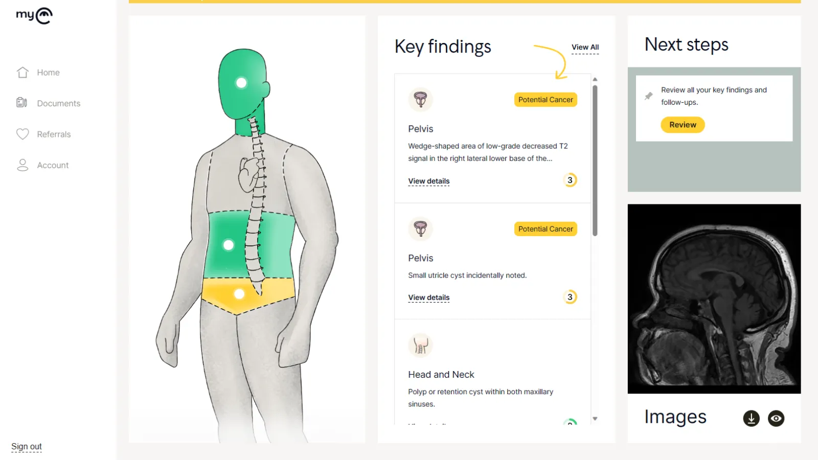 Ezra Full-Body Report