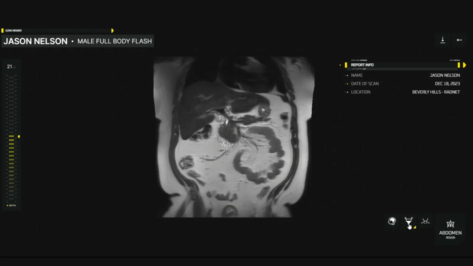 Ezra Scan of Jason's Abdomen