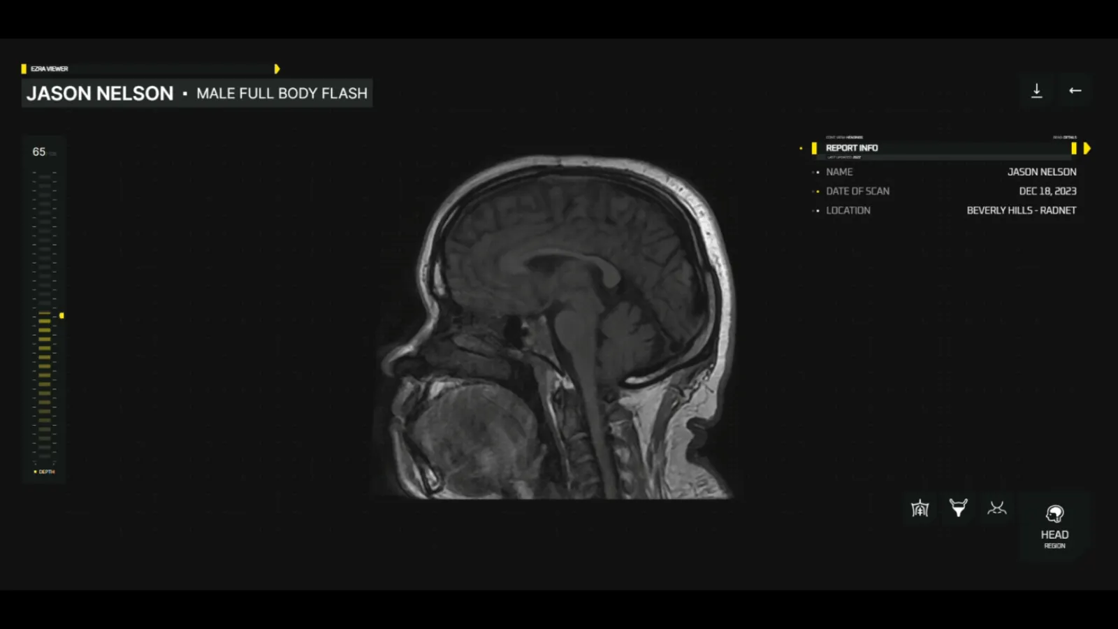 What You Need To Know Before Getting a Full-Body CT Scan - Ezra