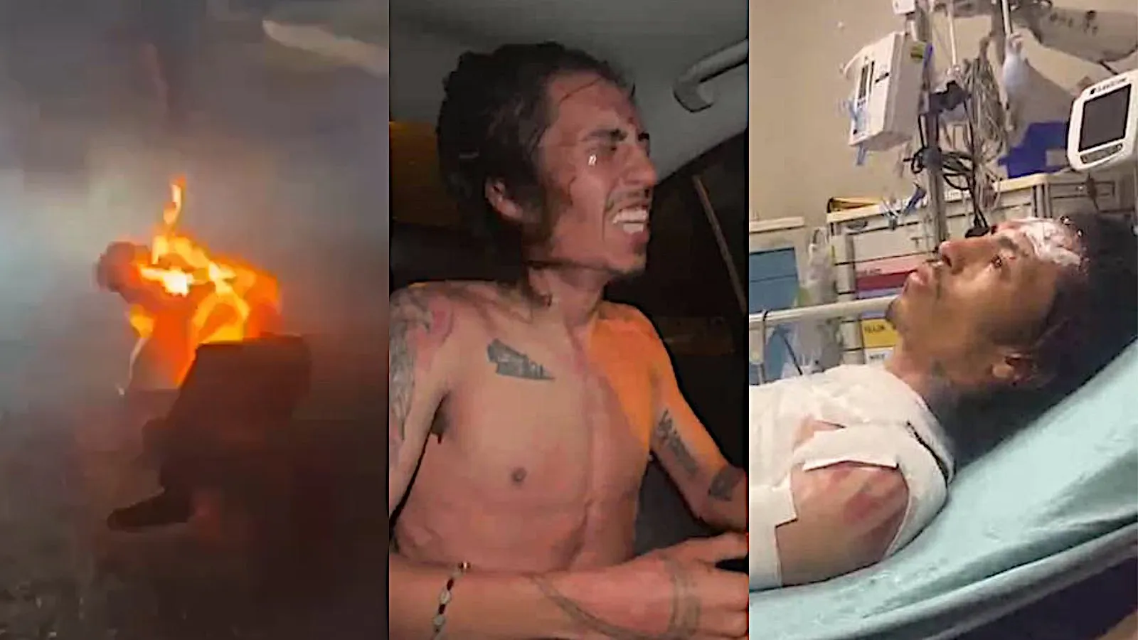 Three images of the TruthOrDare dev throughout the event. First image shows him on fire, rolling on the ground. Second image is him in the back of the car, visibly in pain. Third image is him wrapped up in hospital, clearly burnt.